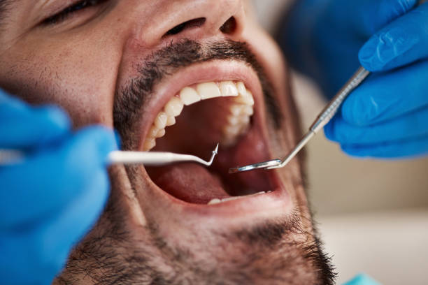 Full Mouth Reconstruction in Smithville, NJ
